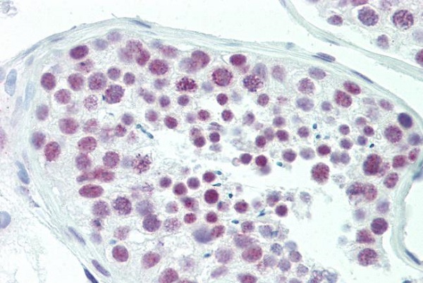 Immunohistochemistry (Formalin/PFA-fixed paraffin-embedded sections) - Anti-LIM domain only 3 antibody (AB230490), expandable thumbnail