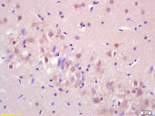 Immunohistochemistry (Formalin/PFA-fixed paraffin-embedded sections) - Anti-LIM Kinase 1 antibody (AB217690), expandable thumbnail