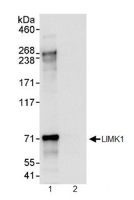 Immunoprecipitation - Anti-LIM Kinase 1 antibody (AB95186)