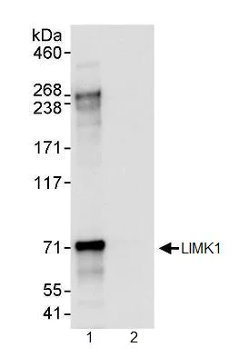 Immunoprecipitation - Anti-LIM Kinase 1 antibody (AB95186)