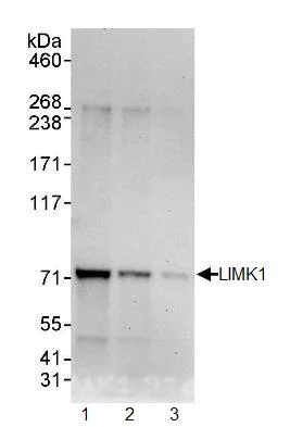 Western blot - Anti-LIM Kinase 1 antibody (AB95186)