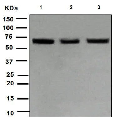 Western blot - Anti-LIM Kinase 1 antibody [EPR912] (AB108507)