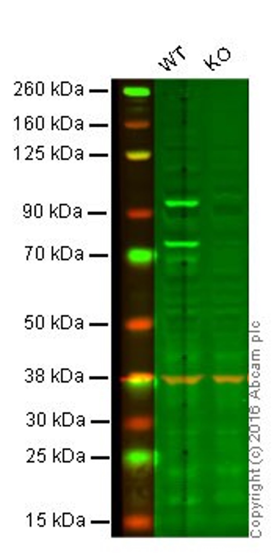 Western blot - Anti-LIM Kinase 1 antibody [EPR912] (AB108507), expandable thumbnail