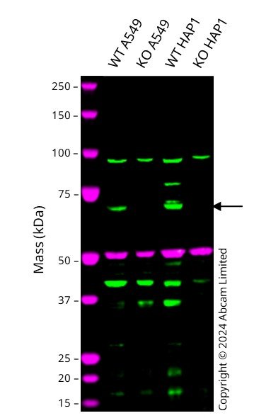 Western blot - Anti-LIM Kinase 1 antibody [EPR912] (AB108507), expandable thumbnail