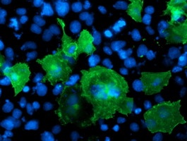 Immunocytochemistry/ Immunofluorescence - Anti-LIM Kinase 1 antibody [OTI3G3] (AB119084), expandable thumbnail