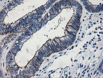 Immunohistochemistry (Formalin/PFA-fixed paraffin-embedded sections) - Anti-LIM Kinase 1 antibody [OTI3G3] (AB119084)