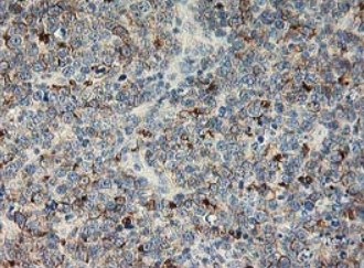 Immunohistochemistry (Formalin/PFA-fixed paraffin-embedded sections) - Anti-LIM Kinase 1 antibody [OTI3G3] (AB119084), expandable thumbnail