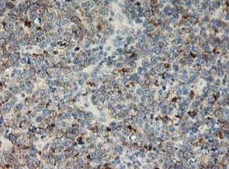 Immunohistochemistry (Formalin/PFA-fixed paraffin-embedded sections) - Anti-LIM Kinase 1 antibody [OTI3G3] (AB119084)