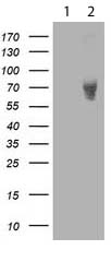 Western blot - Anti-LIM Kinase 1 antibody [OTI3G3] (AB119084), expandable thumbnail