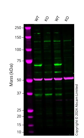 Western blot - Anti-LIM Kinase 1 antibody [OTI3G3] (AB119084)