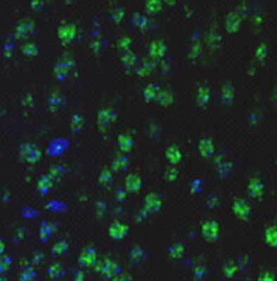 Immunohistochemistry (Formalin/PFA-fixed paraffin-embedded sections) - Anti-LIM Kinase 1 (phospho T508) antibody (AB38508), expandable thumbnail