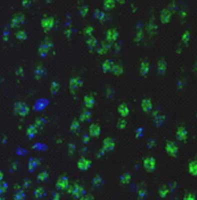 Immunohistochemistry (Formalin/PFA-fixed paraffin-embedded sections) - Anti-LIM Kinase 1 (phospho T508) antibody (AB38508)