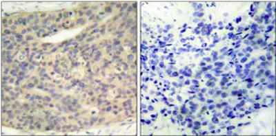 Immunohistochemistry (Formalin/PFA-fixed paraffin-embedded sections) - Anti-LIM Kinase 1 (phospho T508) antibody (AB38508)