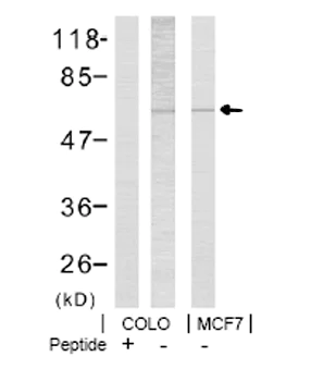 Western blot - Anti-LIM Kinase 1 (phospho T508) antibody (AB38508)