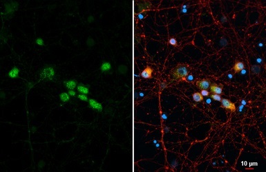 Immunocytochemistry/ Immunofluorescence - Anti-LIM1/LHX1 antibody (AB229474)