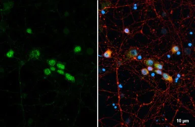 Immunocytochemistry/ Immunofluorescence - Anti-LIM1/LHX1 antibody (AB229474)