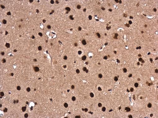 Immunohistochemistry (Formalin/PFA-fixed paraffin-embedded sections) - Anti-LIM1/LHX1 antibody (AB229474), expandable thumbnail