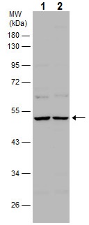 Western blot - Anti-LIM1/LHX1 antibody (AB229474), expandable thumbnail