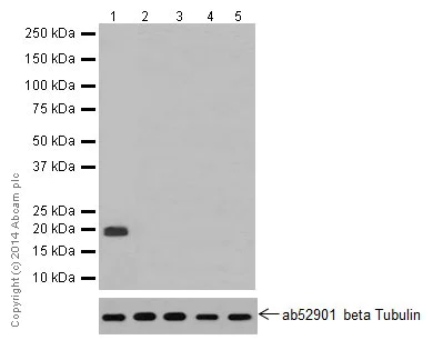 Western blot - Anti-LIM2 antibody [EPR16947] - BSA and Azide free (AB251257)