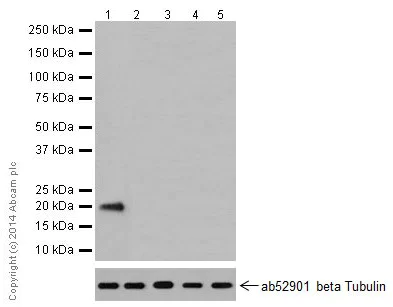 Western blot - Anti-LIM2 antibody [EPR16947] - BSA and Azide free (AB251257)