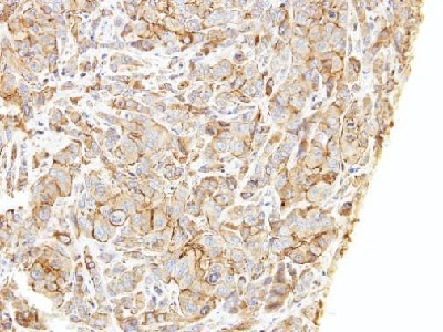 Immunohistochemistry (Formalin/PFA-fixed paraffin-embedded sections) - Anti-LIMCH1 antibody (AB96178), expandable thumbnail