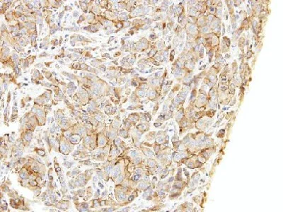 Immunohistochemistry (Formalin/PFA-fixed paraffin-embedded sections) - Anti-LIMCH1 antibody (AB96178)