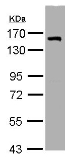 Western blot - Anti-LIMCH1 antibody (AB96178), expandable thumbnail