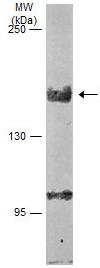 Western blot - Anti-LIMCH1 antibody (AB96178), expandable thumbnail