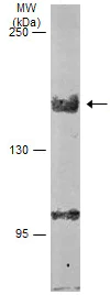 Western blot - Anti-LIMCH1 antibody (AB96178)