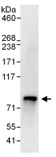 Immunoprecipitation - Anti-LIMD1 antibody (AB114104)