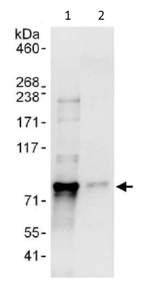 Immunoprecipitation - Anti-LIMD1 antibody (AB225714)