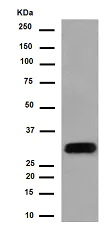 Western blot - Anti-LIME antibody [EPR14713] (AB188871)