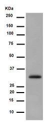 Western blot - Anti-LIME antibody [EPR14713] (AB188871)