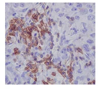 Immunohistochemistry (Formalin/PFA-fixed paraffin-embedded sections) - Anti-LIME antibody [EPR14713] - BSA and Azide free (AB250980)