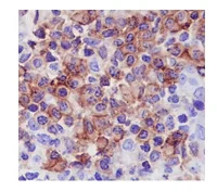 Immunohistochemistry (Formalin/PFA-fixed paraffin-embedded sections) - Anti-LIME antibody [EPR14713] - BSA and Azide free (AB250980)