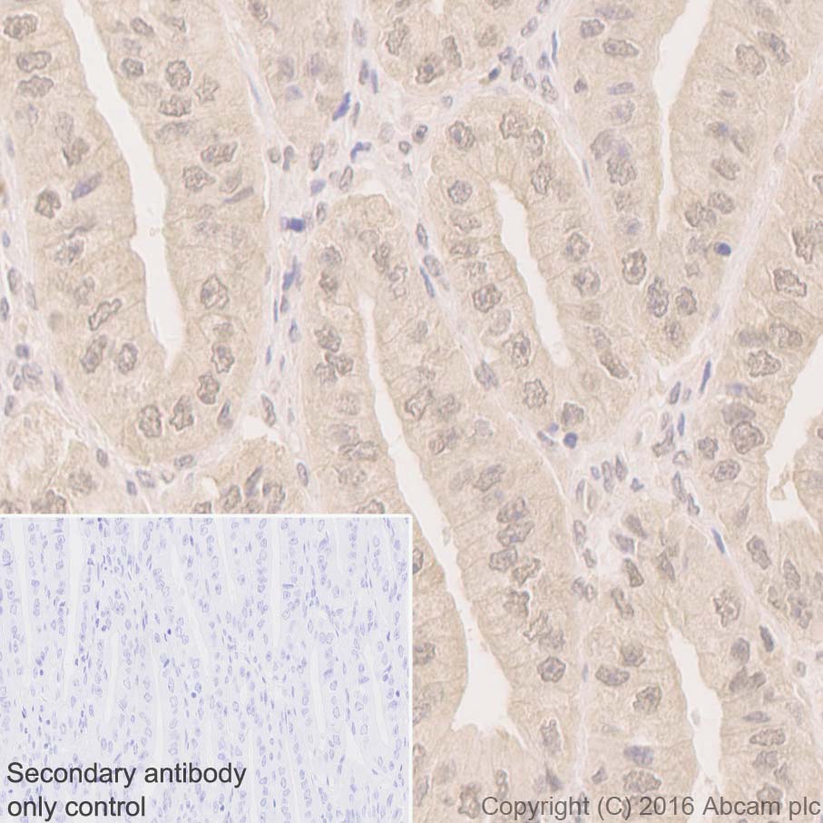 Immunohistochemistry (Formalin/PFA-fixed paraffin-embedded sections) - Anti-LIMK2 antibody [EP969Y] - BSA and Azide free (AB236007)