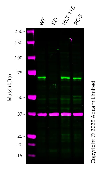 Western blot - Anti-LIMK2 antibody [EP969Y] - BSA and Azide free (AB236007)