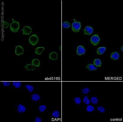 Immunocytochemistry/ Immunofluorescence - Anti-LIMK2 antibody [EP969Y] - C-terminal (AB45165)