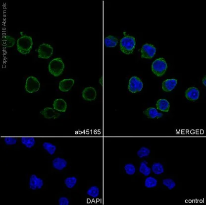 Immunocytochemistry/ Immunofluorescence - Anti-LIMK2 antibody [EP969Y] - C-terminal (AB45165)