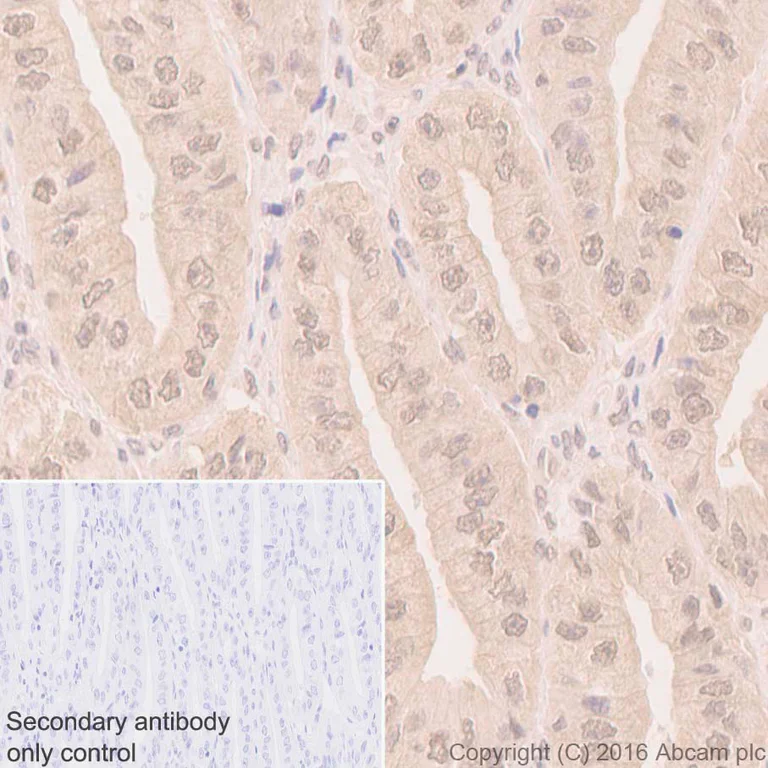 Immunohistochemistry (Formalin/PFA-fixed paraffin-embedded sections) - Anti-LIMK2 antibody [EP969Y] - C-terminal (AB45165)