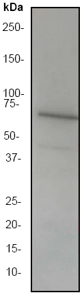 Western blot - Anti-LIMK2 antibody [EP969Y] - C-terminal (AB45165)