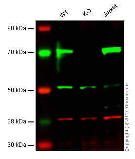 Western blot - Anti-LIMK2 antibody [EP969Y] - C-terminal (AB45165)