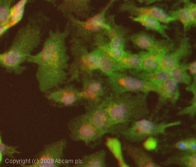 Immunocytochemistry/ Immunofluorescence - Anti-LIMK2 (phospho T505) antibody (AB38499), expandable thumbnail