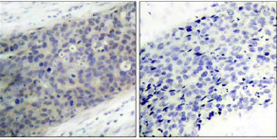 Immunohistochemistry (Formalin/PFA-fixed paraffin-embedded sections) - Anti-LIMK2 (phospho T505) antibody (AB38499), expandable thumbnail