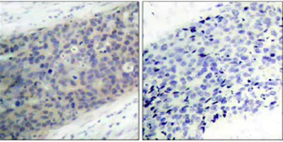 Immunohistochemistry (Formalin/PFA-fixed paraffin-embedded sections) - Anti-LIMK2 (phospho T505) antibody (AB38499)
