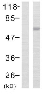 Western blot - Anti-LIMK2 (phospho T505) antibody (AB38499), expandable thumbnail