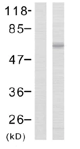 Western blot - Anti-LIMK2 (phospho T505) antibody (AB38499)