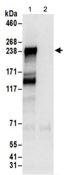 Immunoprecipitation - Anti-LIMKAIN B1 antibody (AB156699)