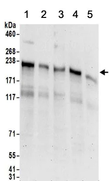 Western blot - Anti-LIMKAIN B1 antibody (AB156699)