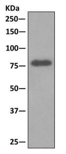 Immunoprecipitation - Anti-LIMPII antibody [EPR12080] (AB176317), expandable thumbnail
